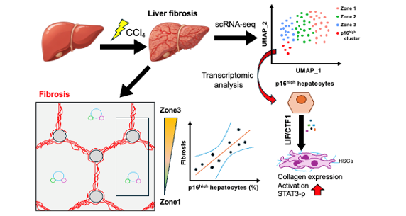 Graphical abstract adapted from: Koji Nishikawa et al., “p16Ink4a-Positive Hepatocytes Drive Liver Fibrosis Through Activation of LIFR Family Pathway,” Advanced Science, first published 25 January 2026, https://doi.org/10.1002/advs.202510562. Licensed under CC BY 4.0. Changes were made (cropped/enlarged for web display).